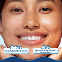 Aqualogica Barrier+ Hydra Gel Moisturizer With 5 Ceramides & Avocado For 24 Hour Intense Hydration (200g)