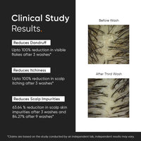 Minimalist Anti-Dandruff Shampoo 3.5% Salicylic Acid For Flaky & Itchy Scalp, Gentle & Sulphate-Free (200ml)