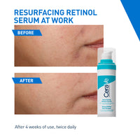 CeraVe Resurfacing Retinol Serum, Reduces Acne Marks with Licorice Root Extract & Niacinamide (30ml)