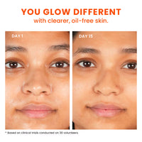 Foxtale Oil Balancing Moisturizer (50ml)