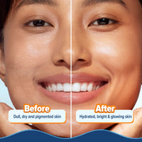 Aqualogica Glow+ Hydra Gel Moisturizer With Papaya & Vitamin C For 24 Hour Intense Hydration (200g)