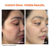 Foxtale Super Glow Moisturiser With 4% VitC-Niacinamide Complex For Brighter Skin (50ml)