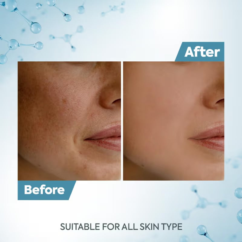 Raaga Professional De Tan Removal Creme With Kojic & Milk(500 gm)