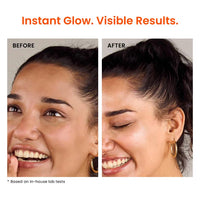 Foxtale Brightening Vitamin C Face Serum With L-Ascorbic Acid And Vitamin E For Glowing Skin (30ml)