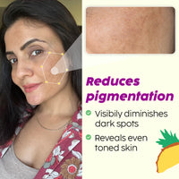 Plix 2% Alpha Arbutin Pineapple Serum for Pigmentation & Dark Spot Reduction (30ml)
