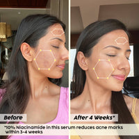 Plix 10% Niacinamide Jamun Face Serum for Acne marks, blemishes & oil control