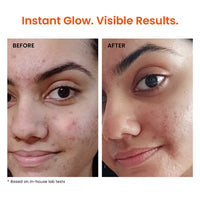 Foxtale 12% Niacinamide Serum with Azelaic Acid for Oil Control & Brightening (30ml)