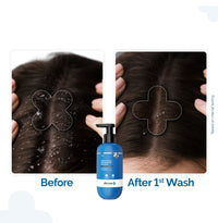 The Derma Co Triple Actives Anti-Dandruff Shampoo | 200ml