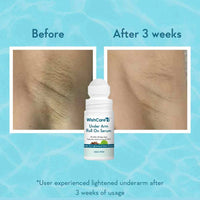 Wish Care Under Arm Roll On Serum 50ml