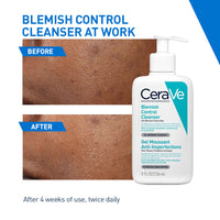 CeraVe Blemish Control Cleanser with 2% Salicylic Acid & Niacinamide for Acne-prone skin (236ml)