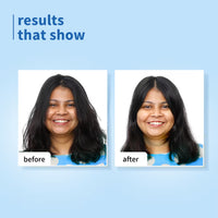 Plum Peptides Shampoo with Coconut Milk for Dry & Rough Hair 22x softer hair in 1 wash (250ml)