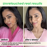 PLIX 5% Pineapple Foaming Facewash For Depigmentation, For Skin Brightening & Even Toned Complexion (100ml)