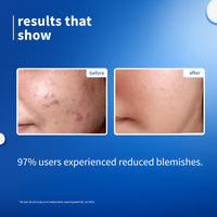 Plum 10% Niacinamide Brightening Face Serum with Rice Water, Fades Acne Marks, for Oily to Dry Skin (50ml)