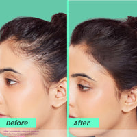 Plix Rosemary Advanced Anti Hair Fall Shampoo (200ml)