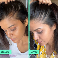 Plix Rosemary Advanced Anti Hair Fall Shampoo (200ml)