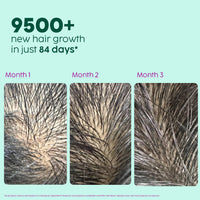 Plix Rosemary Hair Growth Serum (30ml)