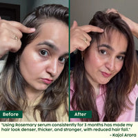 Plix Rosemary Hair Growth Serum (30ml)