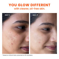 Foxtale Oil and Acne Control Face Wash – Fights Acne, Calms Skin, No Dryness (100ml)