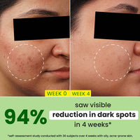 Dot & Key Cica + 10% Niacinamide Spot Reduction Face Serum, Treats Acne Scars & Dark Spots