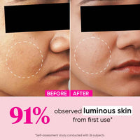 Dot & Key Watermelon + 10% Glycolic Gentle Exfoliating Face Serum, With Kojic, Controls Excess Oil (30ml)