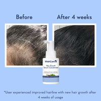 Wishcare Hair Growth Serum Concentrate|In-Vivo Tested|Redensyl, Anagain, Biotin,Keratin & Rice Water (30ml)